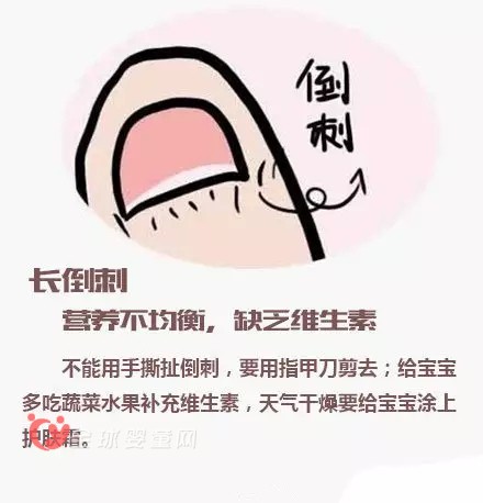 寶寶指甲透露出來的健康問題 爸爸媽媽注意到了嗎？