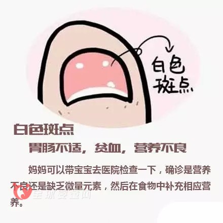 寶寶指甲透露出來的健康問題 爸爸媽媽注意到了嗎？