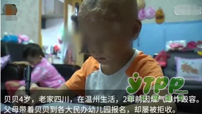 毀容男童艱難入學(xué) 你愿意讓孩子和他玩嗎