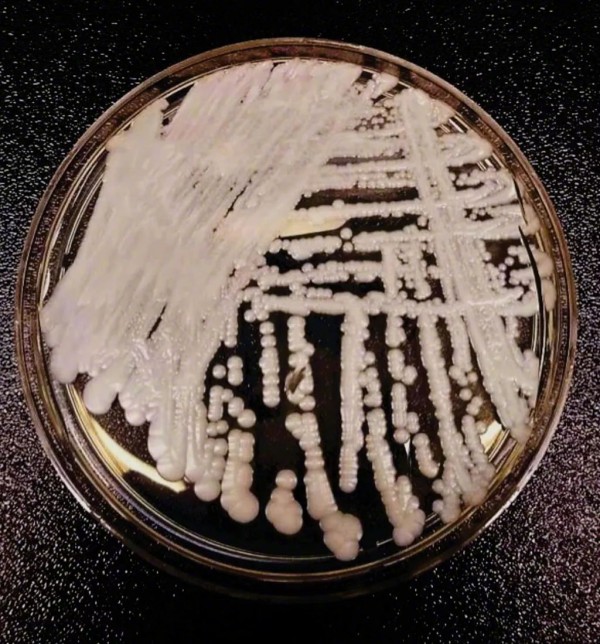 致死率60%的#超级真菌在美国多地爆发#  中国已有18例确认感染