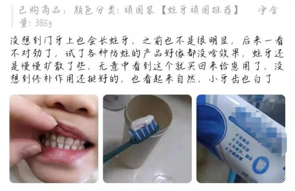儿童补牙贩卖低龄矫治牙齿的焦虑   “功能性牙膏”究竟能不能信？